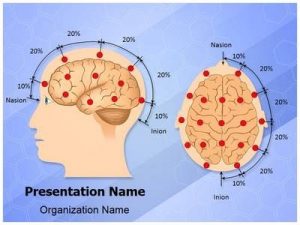 Neurofeedback en Autismo y Déficit de atención