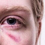 Trastorno de Estrés Postraumático (TEPT): Entenderlo para Recuperarse